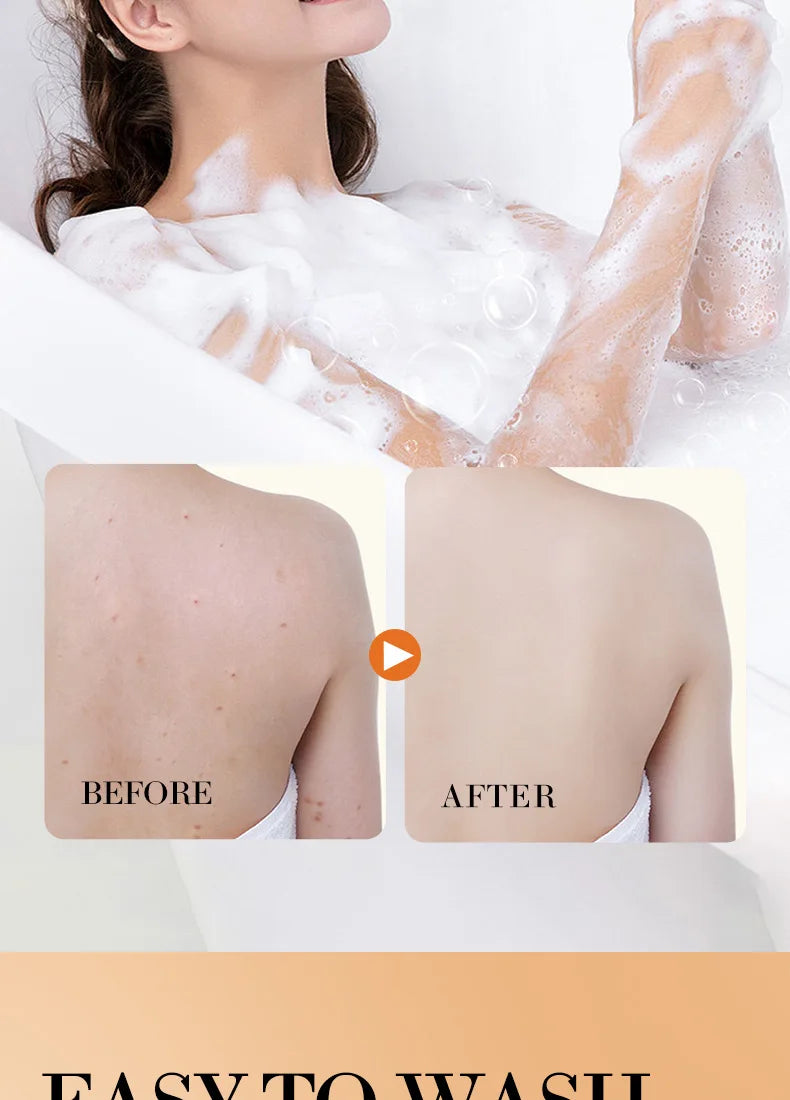 Turmeric Soap Body Cleaning Lightening Dark Underarm